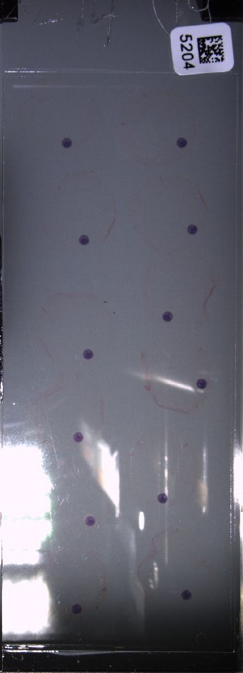 Media type: image; Special Collections 4011   shows specimen_part histological serial section;